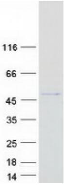 Coomassie blue staining of purified GSK3B protein.